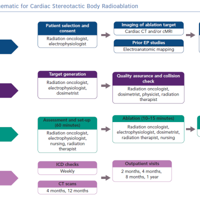 Workflow Schematic for Cardiac Stereotactic Body Radioablation