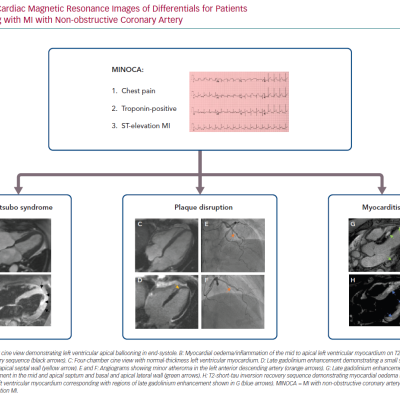 Cardiac Magnetic Resonance Images of Differentials for Patients