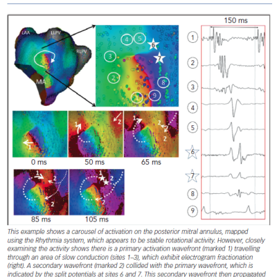 Pseudo Re-entrant Circuits Composed of Multiple Wavefronts May Appear as Stable Rotational Activity