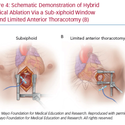 Schematic Demonstration of Hybrid