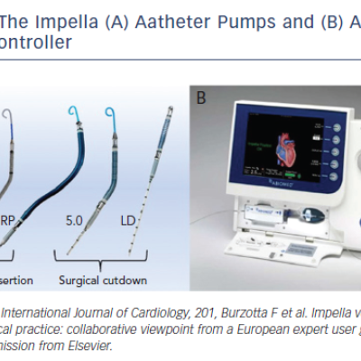 Figure 4 The Impella A Aatheter Pumps and B Automated Impella Controller