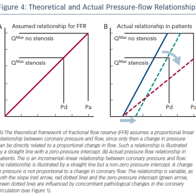 Figure 4 Theoretical and Actual Pressure-flow Relationships