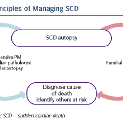 Principles of Managing SCD