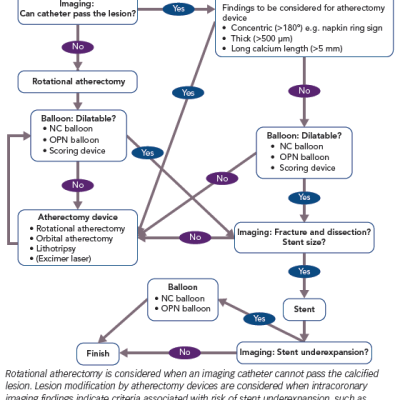 Treatment Algorithm for a Calcified Lesion