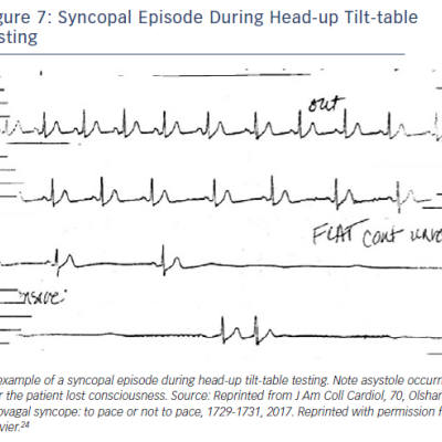 Figure 7 Syncopal Episode During Head-up Tilt-table Testing