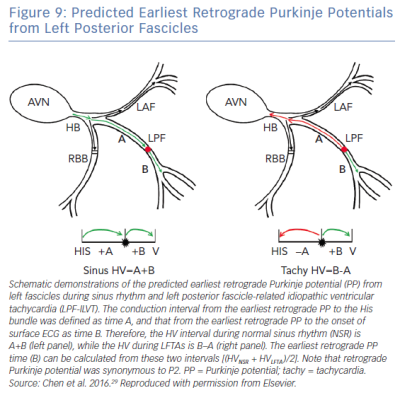 Predicted Earliest Retrograde Purkinje Potentials from Left Posterior Fascicles