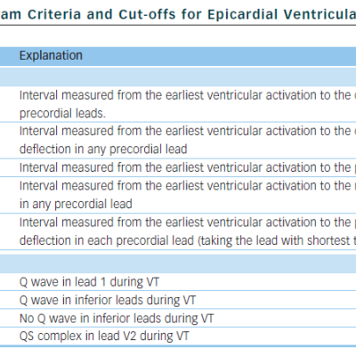 Table 1 Proposed Electrocardiogram Criteria and Cut-offs for Epicardial Ventricular Tachycardia Origin