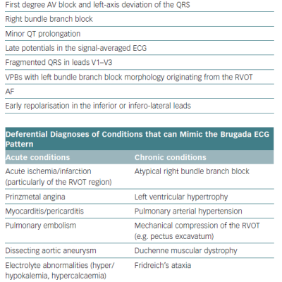 Commonly Associated ECG Findings and Differential Diagnoses