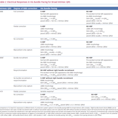 Electrical Responses in His Bundle Pacing