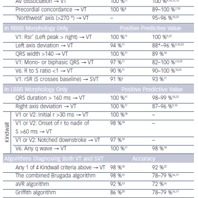 Table 2 Predictive Values and Accuracies of the Most Common Ventricular Tachycardia Criteria