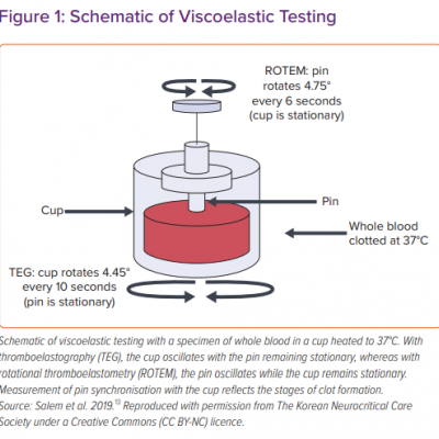 Schematic of Viscoelastic Testing