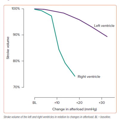 Stroke Volume and Afterload