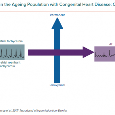 Atrial Arrhythmias in the Ageing Population with Congenital Heart Disease Changing Types and Patterns