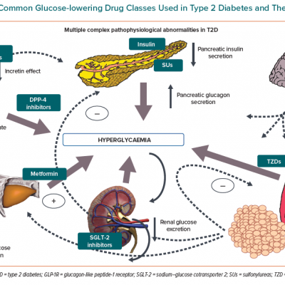 The Most Common Glucose-lowering Drug Classes Used in Type 2 Diabetes and Their Sites of Action