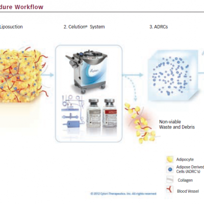 Celution Procedure Workflow