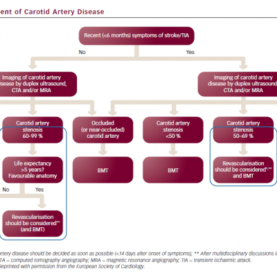 Management of Carotid Artery Disease