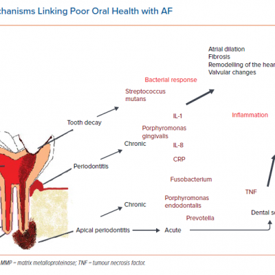 Proposed Mechanisms Linking Poor Oral Health with AF