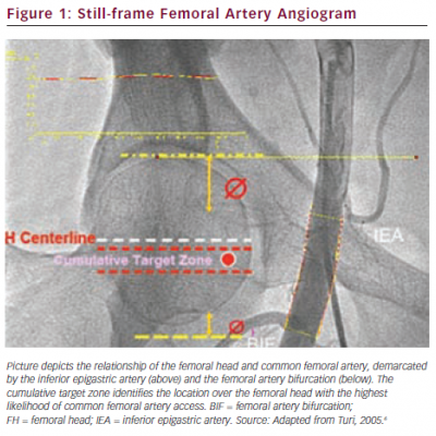 Still-frame Femoral Artery Angiogram