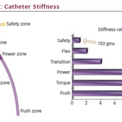 Catheter Stiffness