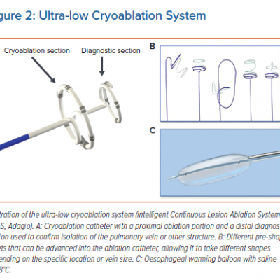 Ultra-low Cryoablation System