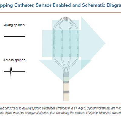 Advisor HD Grid Mapping Catheter Sensor Enabled and Schematic Diagram of the HD Wave Solution