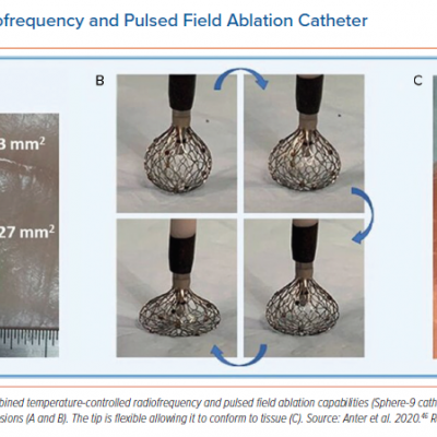 Lattice-tipped Radiofrequency and Pulsed Field Ablation Catheter