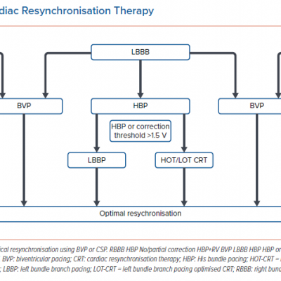 Schematic for Cardiac Resynchronisation Therapy