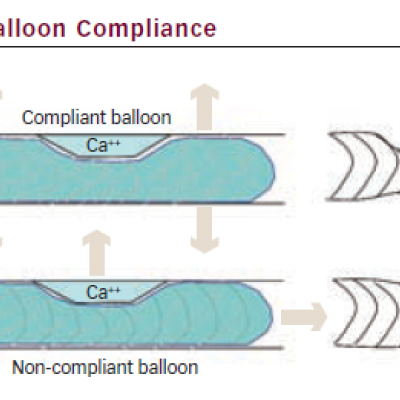 Balloon Compliance