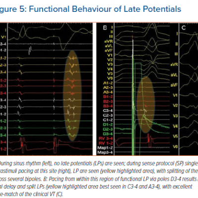 Functional Behaviour of Late Potentials