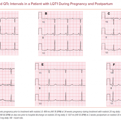 Prolonged QTc Intervals in a Patient with LQT1 During Pregnancy and Postpartum