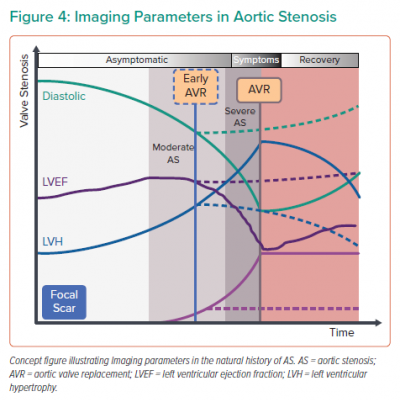 Imaging Parameters in Aortic Stenosis