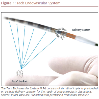 Tack Endovascular System