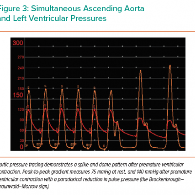 Simultaneous Ascending Aorta and Left Ventricular Pressures