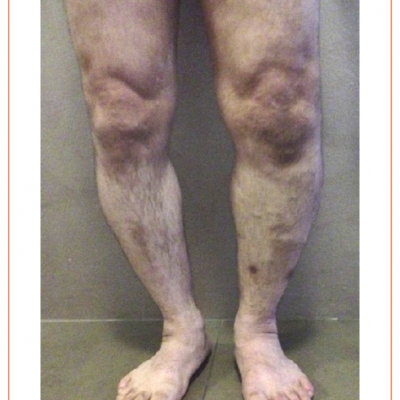 The Patient’s Lower Limbs