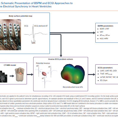 Schematic Presentation of BSPM and ECGI Approaches to Determine Electrical Synchrony in Heart Ventricles