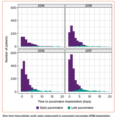 Time from Transcatheter Aortic Valve Replacement to Permanent Pacemaker Implantation