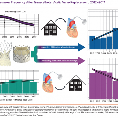 Pacemaker Frequency After Transcatheter Aortic Valve Replacement 2012–2017