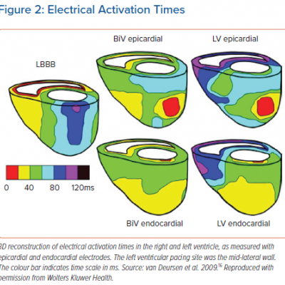 Electrical Activation Times