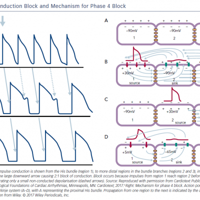 Figure 1 Phase 3 Conduction Block and Mechanism for Phase 4 Block
