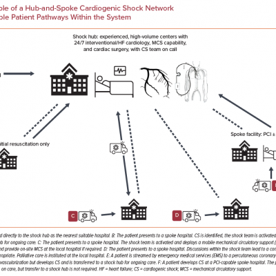 Example of a Hub-and-Spoke Cardiogenic Shock Network Showing Possible Patient Pathways Within the System
