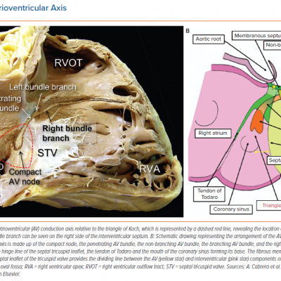 Human Atrioventricular Axis
