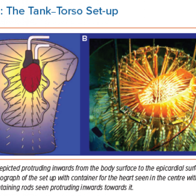 The Tank–Torso Set-up