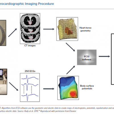 The Electrocardiographic Imaging Procedure