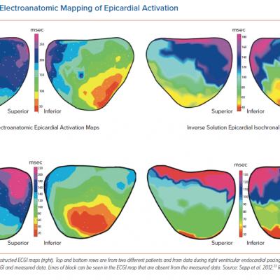 Contact Electroanatomic Mapping of Epicardial Activation