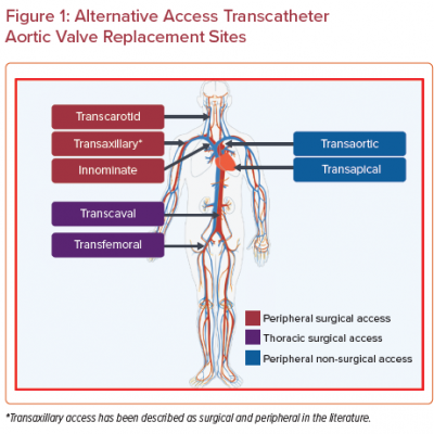 Alternative Access Transcatheter Aortic Valve Replacement Sites