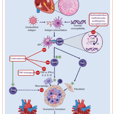 Immunopathogenesis of Granuloma Formation and Therapeutic Targets in Cardiac Sarcoidosis