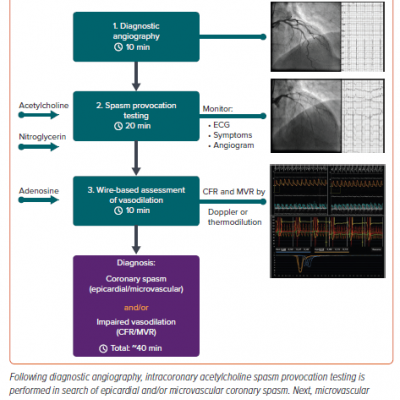 Comprehensive Assessment of Coronary Function Using an Interventional Diagnostic Procedure