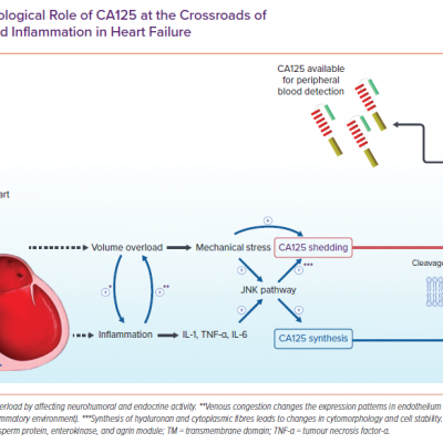 Pathophysiological Role of CA125 at the Crossroads of Volume Overload and Inflammation in Heart Failure