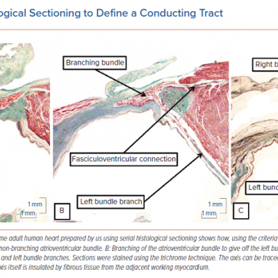 Using Serial Histological Sectioning to Define a Conducting Tract