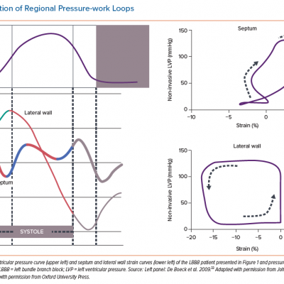 Calculation of Regional Pressure-work Loops
